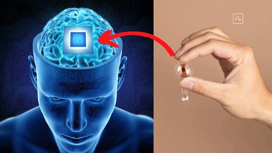 Этично ли вживлять чип в человеческий мозг?
