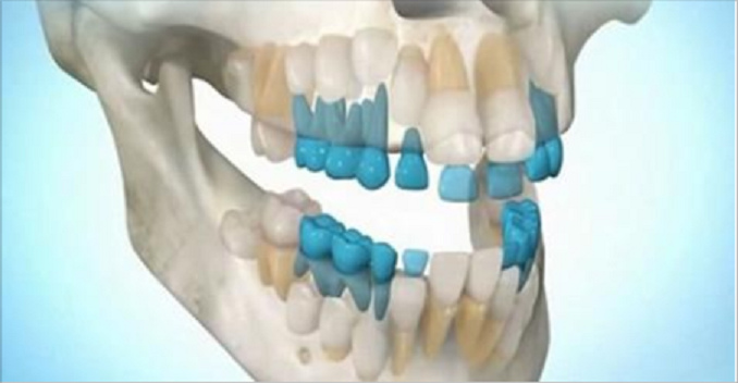 Вы можете вырастить собственные зубы за 9 недель!Попрощайтесь с зубными имплантами!